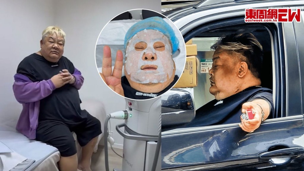 林雪回應左臉黑斑變深色變大原因 直言變靚仔後再跟大家見面：多謝關心!