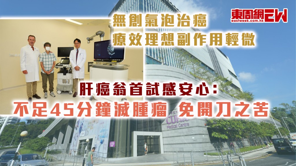 無創氣泡治癌︱療效理想副作用輕微 肝癌翁首試感安心﹕不足45分鐘滅腫瘤 免開刀之苦
