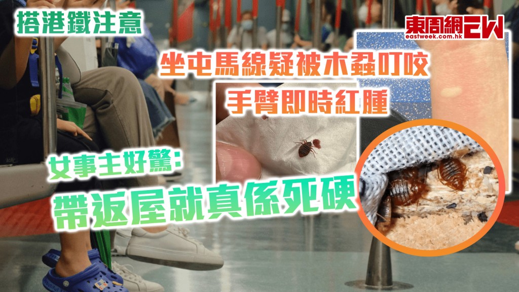 搭港鐵注意｜坐屯馬線疑被木蝨叮咬 手臂即時紅腫 女事主好驚﹕帶返屋就真係死硬