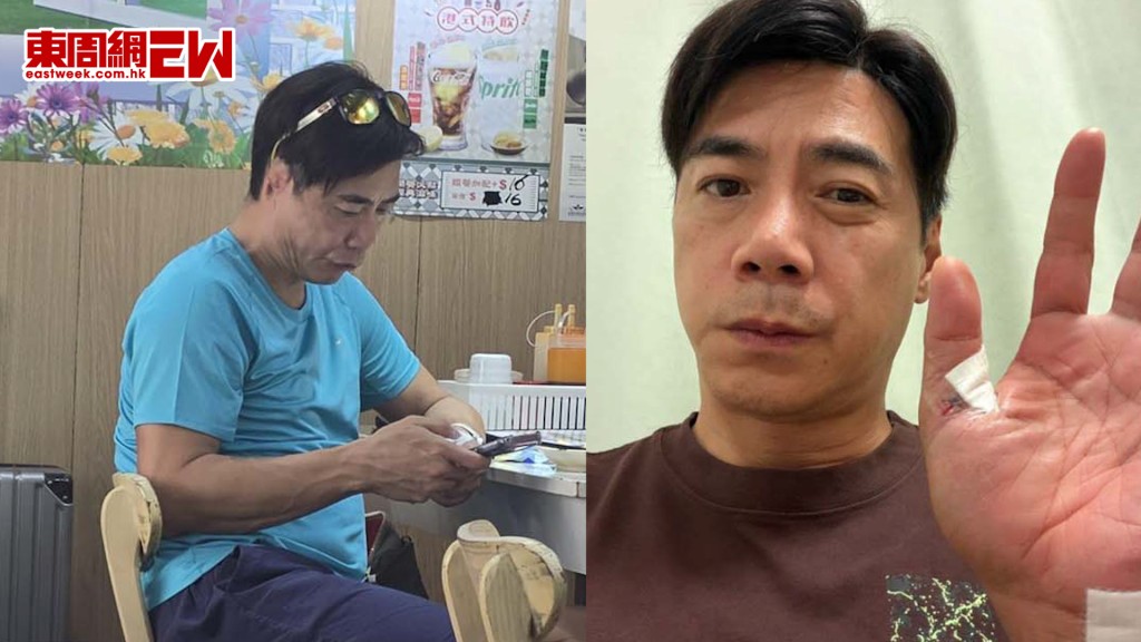 崔錦棠 手傷未癒