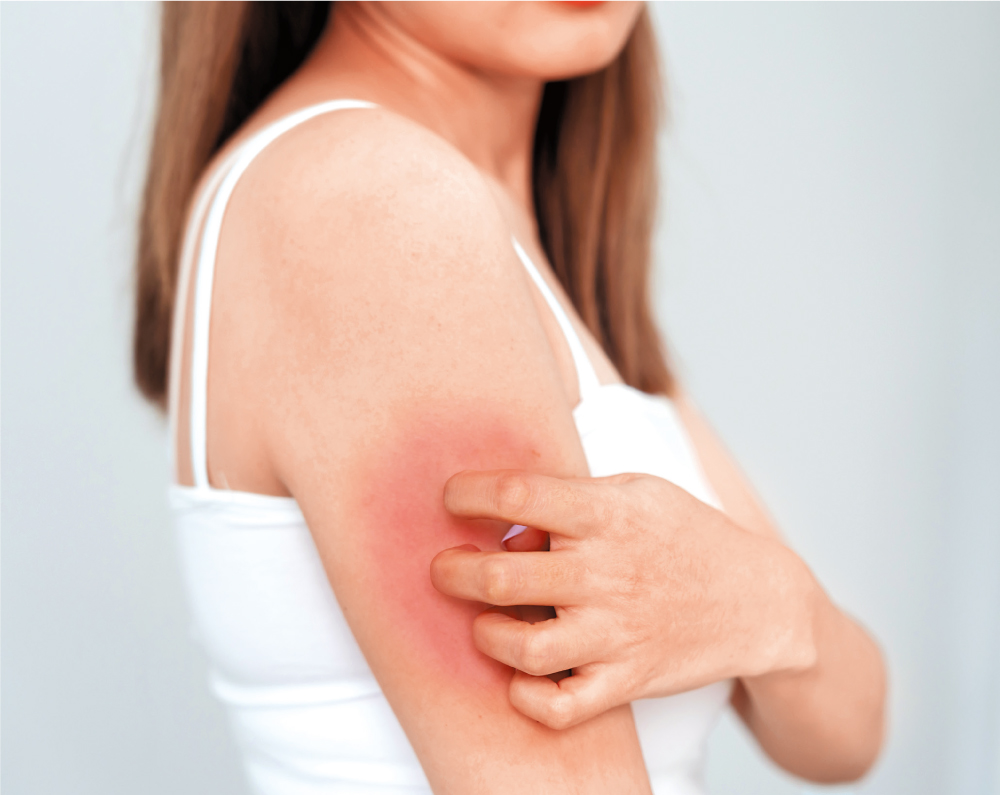 因為腸道屏障失效,激起發炎因子的反應,皮膚就會出現紅、損、痕等情況。 因為腸道屏障失效,激起發炎因子的反應,皮膚就會出現紅、損、痕等情況。