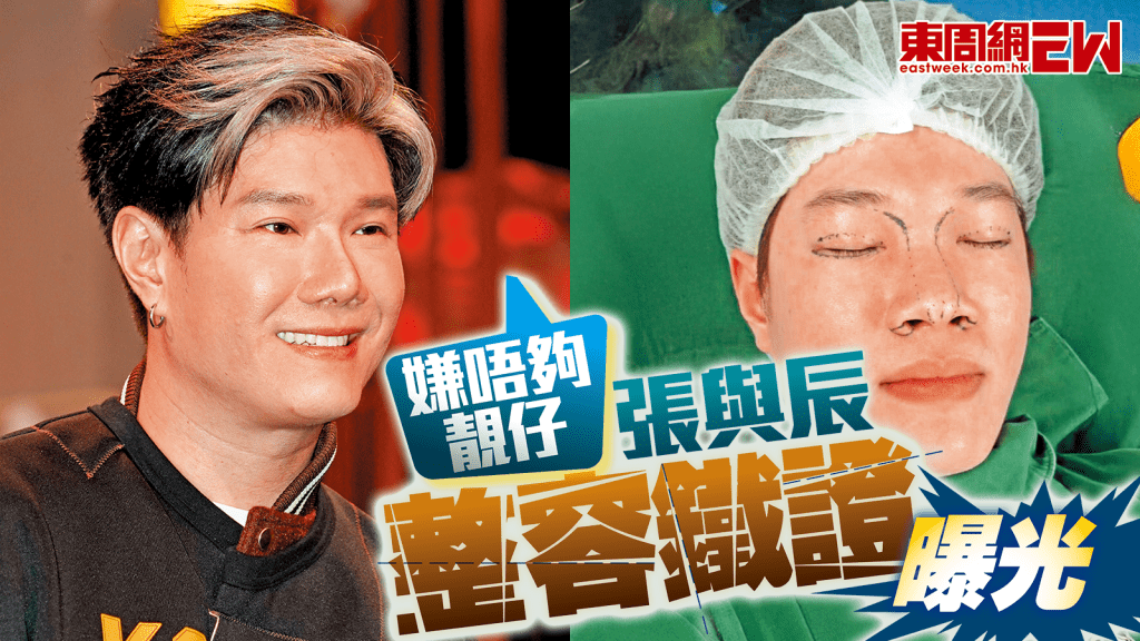 張與辰嫌唔夠靚仔 整容鐵證曝光