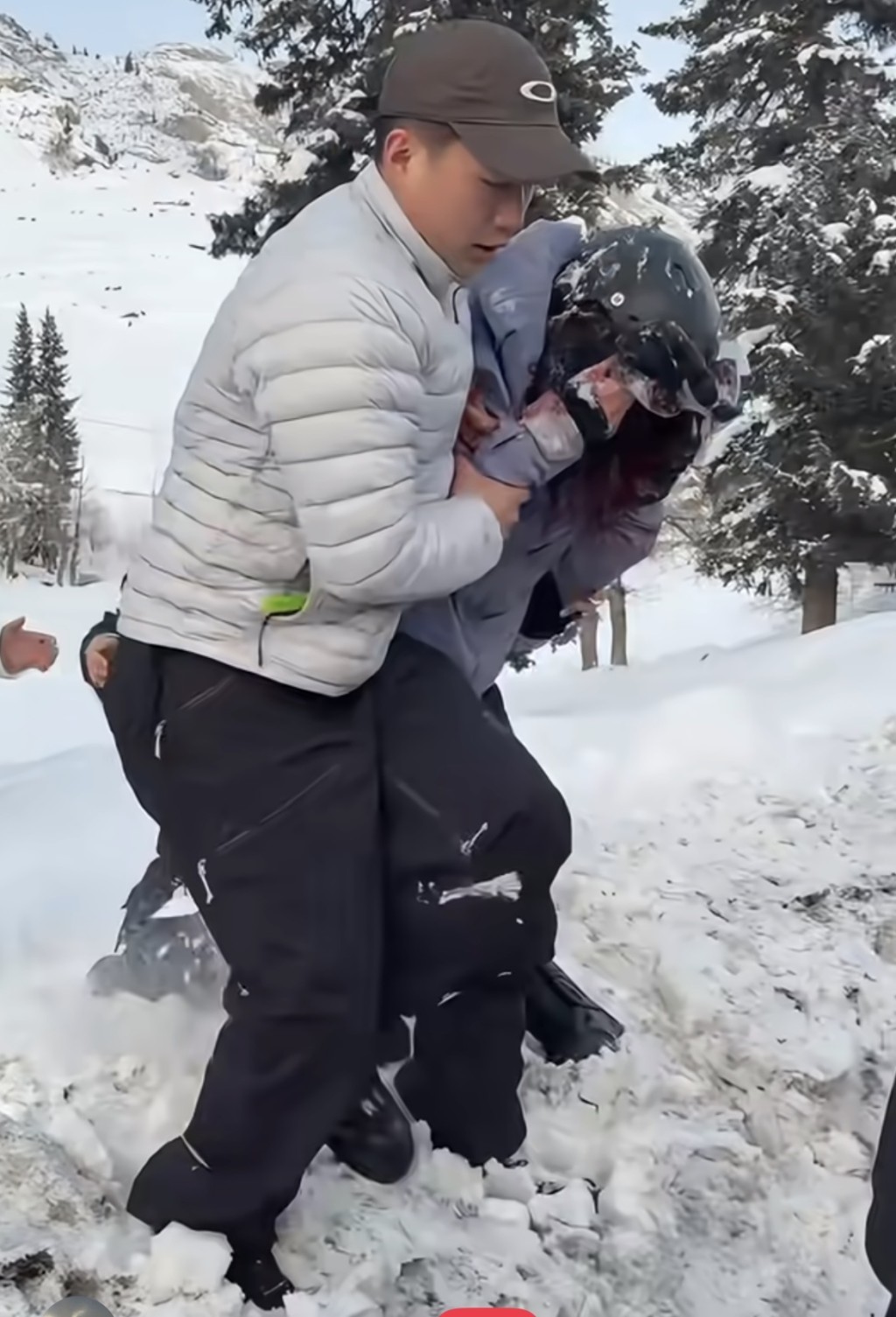 受傷女遊客用手掩面。 受傷女遊客用手掩面。