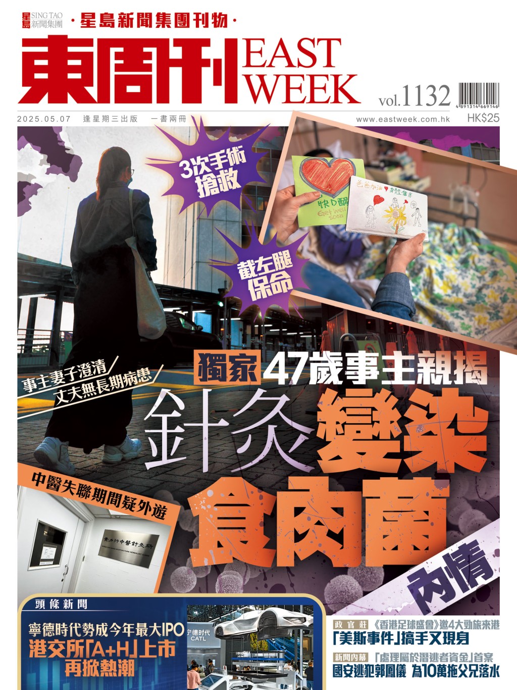 《東周刊》第1132期|截左腿保命 47歲事主親揭 針灸變染食肉菌內情 《東周刊》第1132期|截左腿保命 47歲事主親揭 針灸變染食肉菌內情