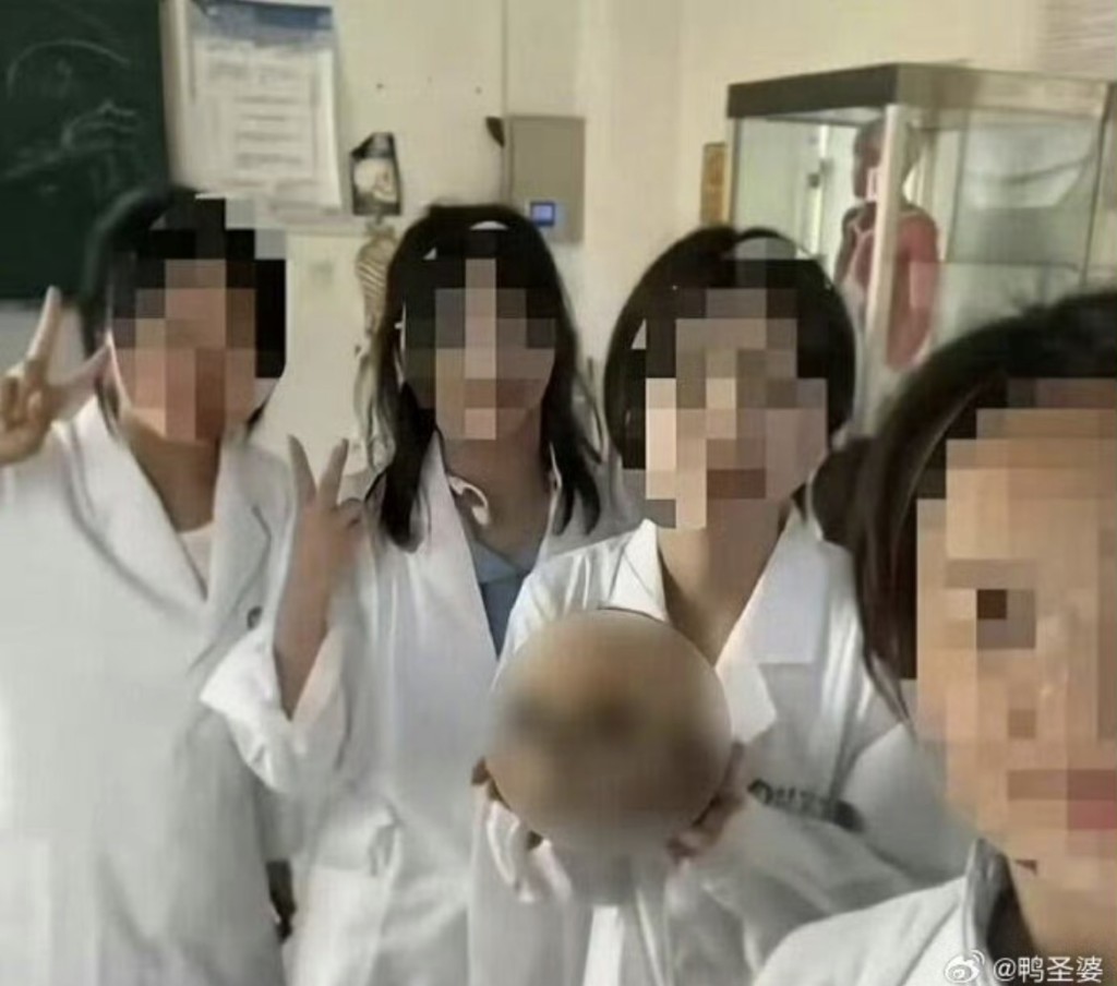 醫科生手捧大體老師頭骨舉V字手勢拍照打卡。 醫科生手捧大體老師頭骨舉V字手勢拍照打卡。