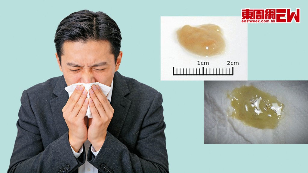 我能從痰的顏色分辨病症？│康健講健康