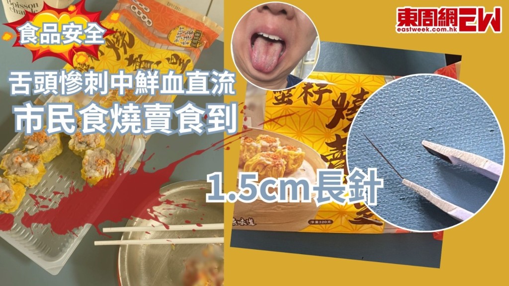 有市民於Facebook 專頁「真.屯門友」發帖表示，之前在屯門巿廣場Aeon 超市購買，牌子是「榮X行蟹籽燒賣」，昨（4日）蒸蟹籽燒賣食，食到最後，發現舌頭刺痛，遂吐出燒賣並連帶血水。樓主表示摸到舌頭中間有倒刺感覺，自行用眉鉗夾出一支針狀物體，表示目測長度有1.5cm。