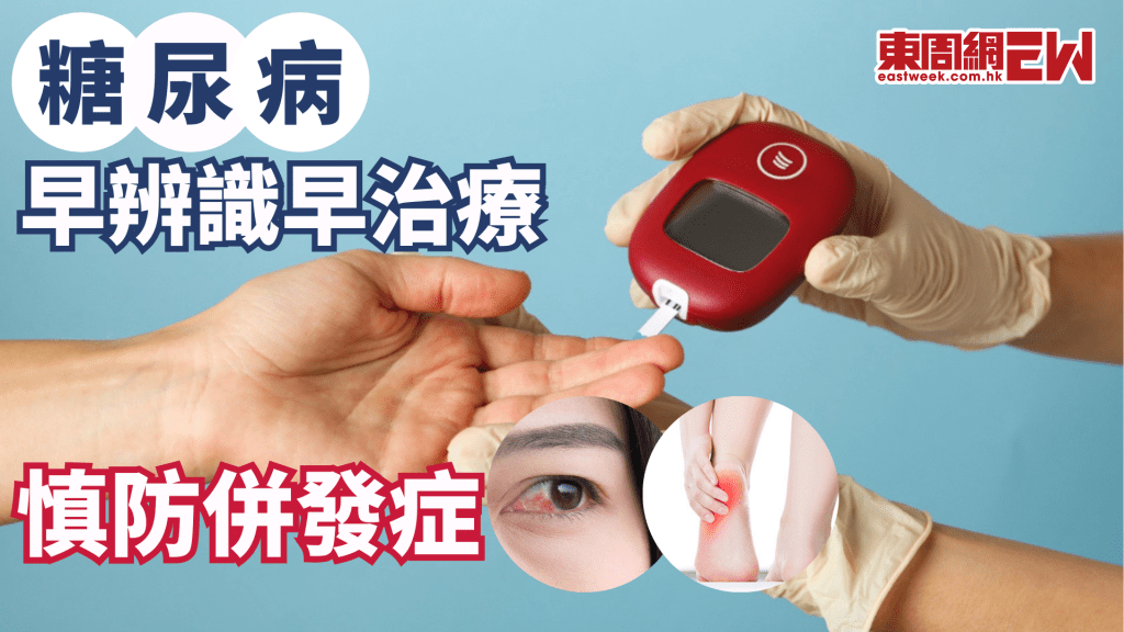 糖尿病早辨識早治療 慎防併發症│康健講健康