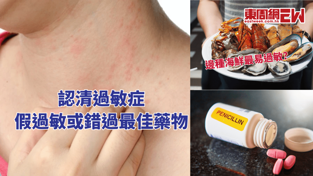 認清過敏症 假過敏或錯過最佳藥物│康健講健康