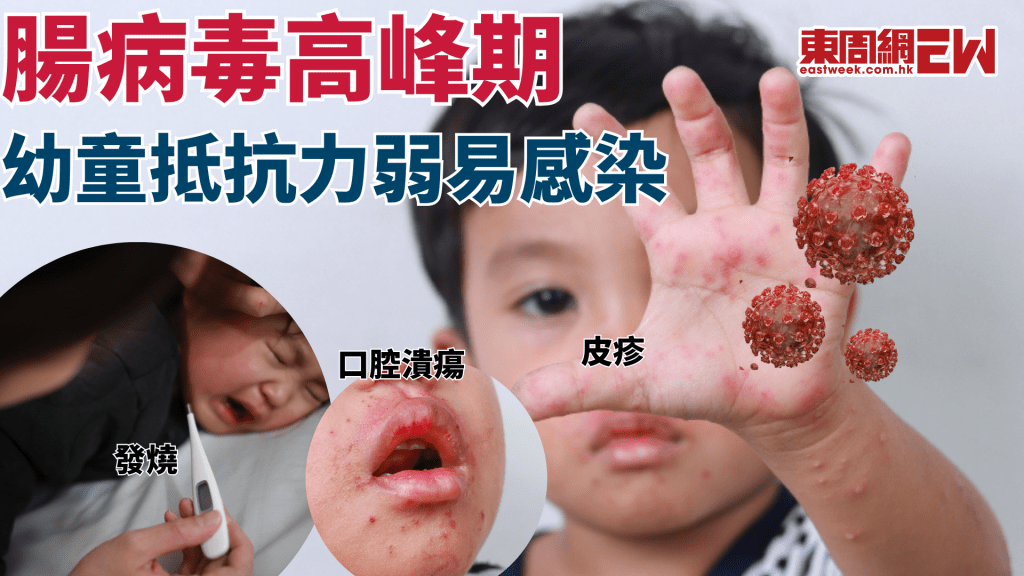 腸病毒EV71專攻幼童腦部 家長必讀開學防護指南│康健講健康