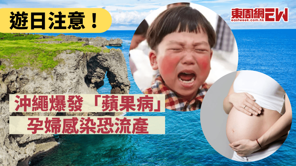 遊日注意 沖繩爆發「蘋果病」孕婦感染恐流產│康健講健康