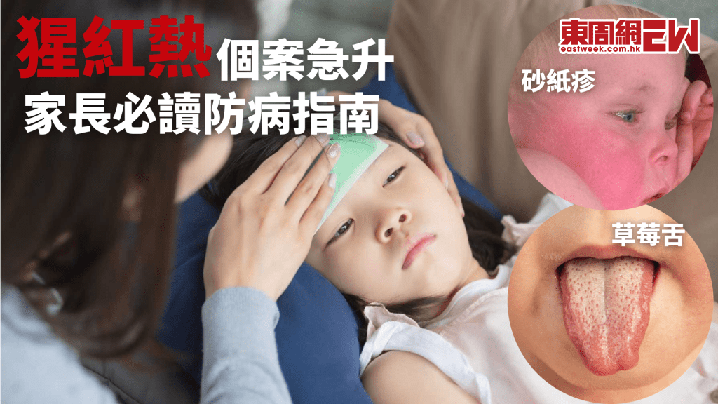 猩紅熱個案近千 5招有效預防病毒 │康健講健康