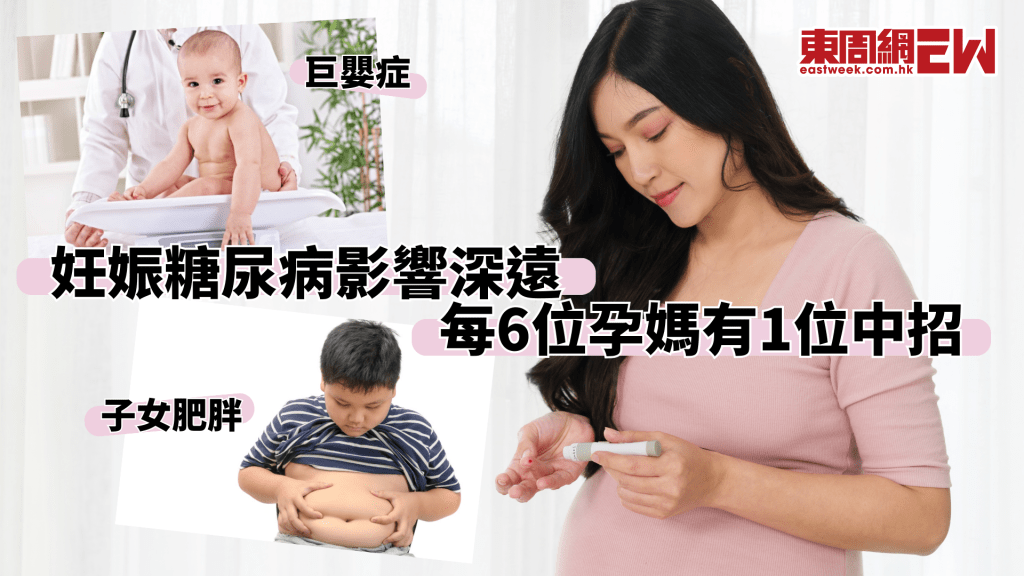 妊娠糖尿病不可忽視 巨嬰症恐難產 增加子女肥胖機率│康健講健康