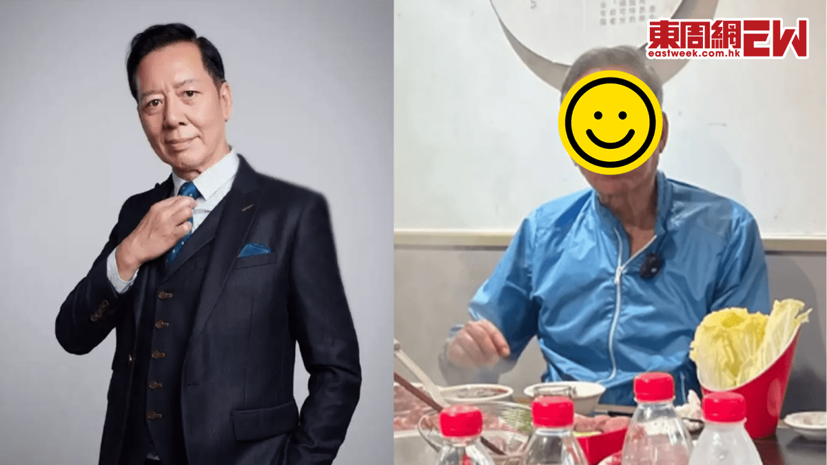 73歲駱應鈞近況曝光  青筋盡現 消瘦不少 早年曾進行兩次繁複手術